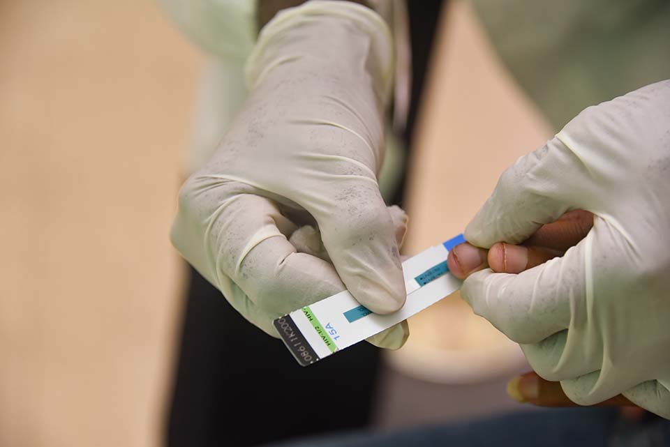 gloved hands holds tuberculosis test strip