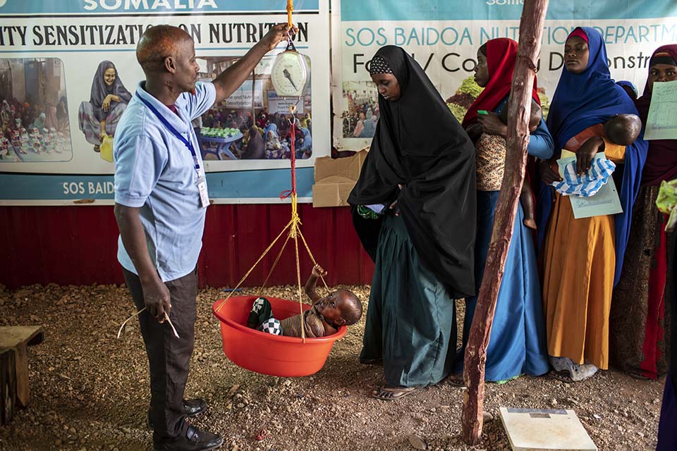 Somali child weighed in clinic